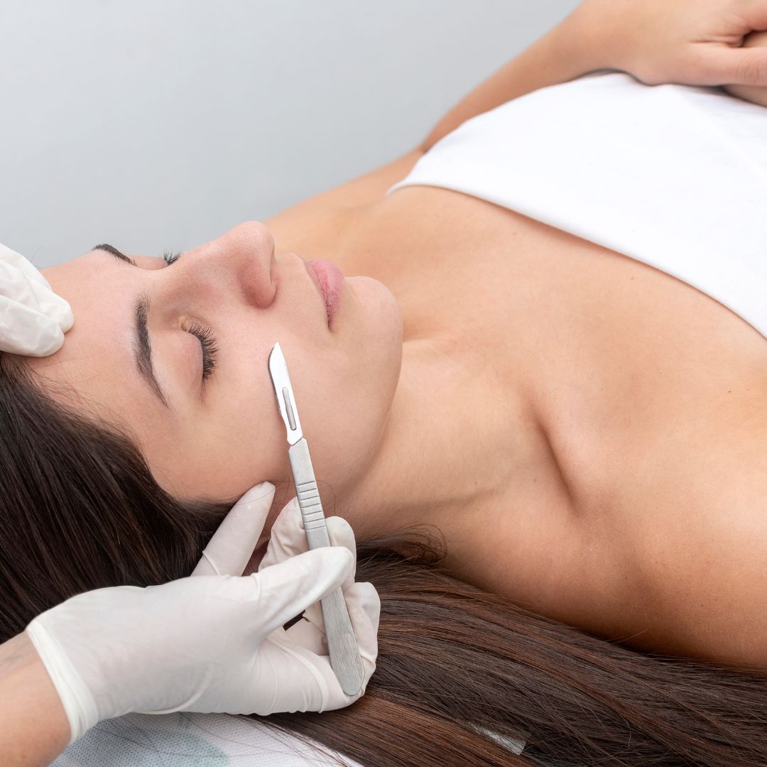 dermaplaning facial near me St Albans